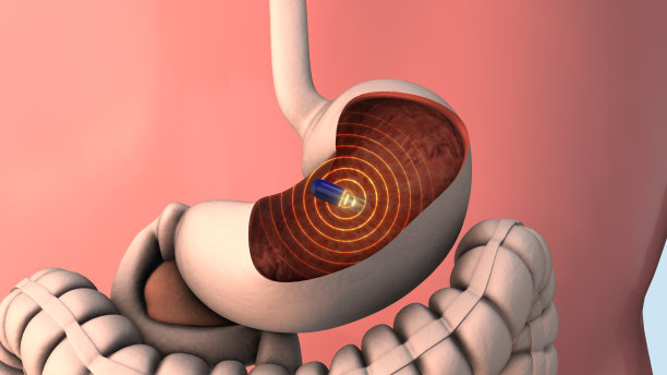 胶囊胃镜