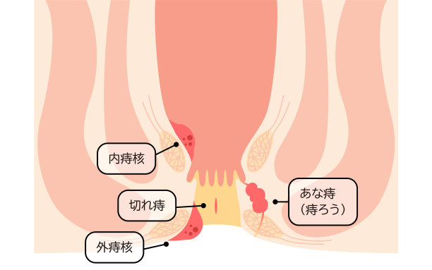 地道肠