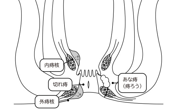 地道肠