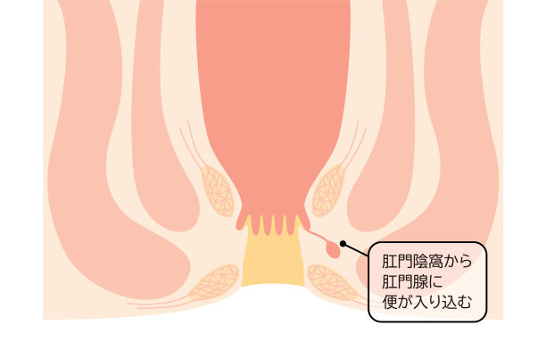 地道肠