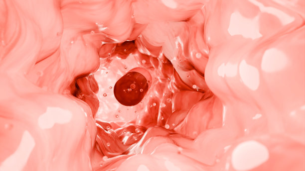 胶囊胃镜