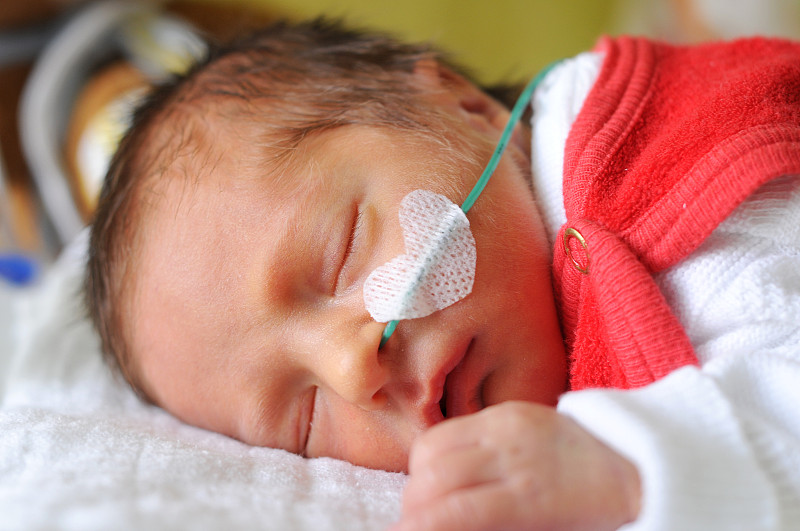 新生儿,早产儿保育器,早产儿,加护病房,产房,浸泡油,创可贴,婴儿,产前护理