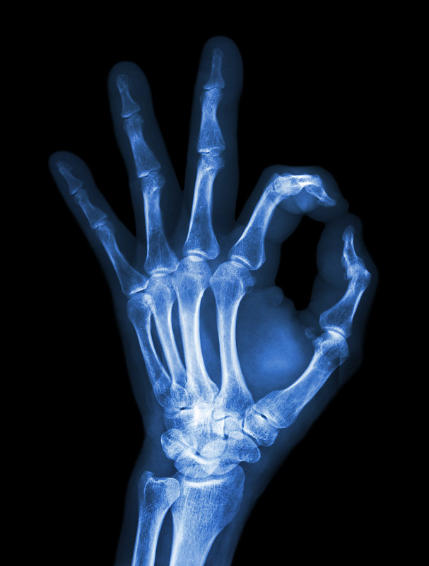 x光,同意的手势,符号,手,x光片,腕骨,英文字母x,前臂,医学扫描,垂直画幅