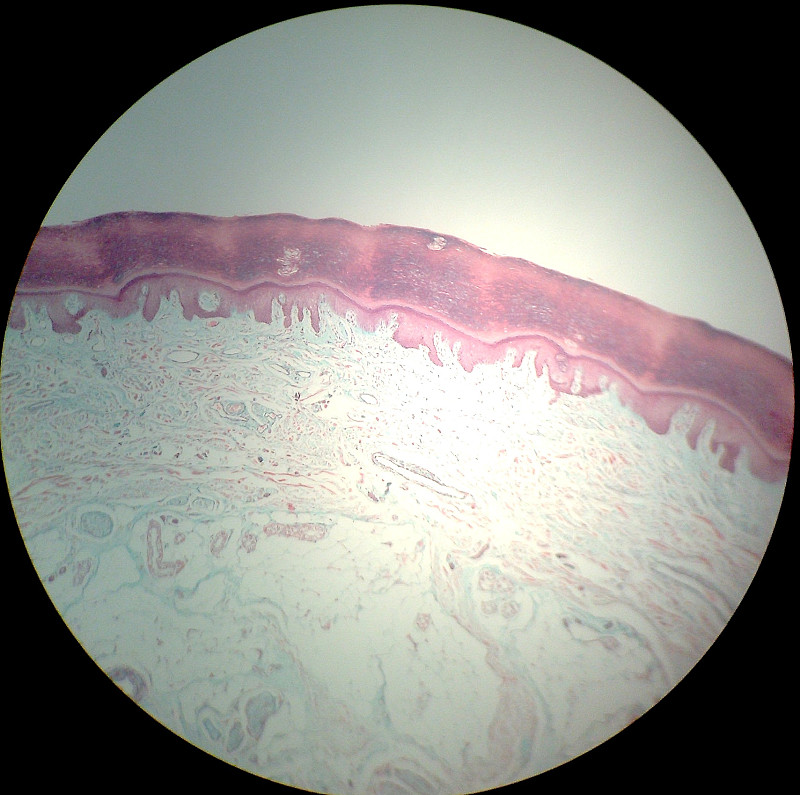 微生物学,皮肤,网状细胞,乳突,复层上皮,鳞状上皮,苏木素伊红染色,真皮层,显微镜载玻片,水平画幅