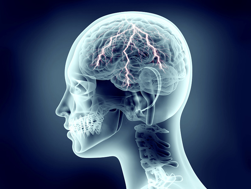 人的头部,x光片,机敏,头痛,灵感,神经系统,水平画幅,能源,智慧,科学