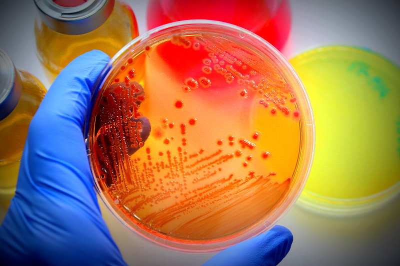 微生物学,皮氏培养皿,生物化学,试管,生物学,实验室,细菌,科学家,食物中毒,检查