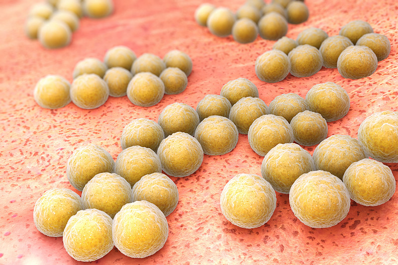 金黄色葡萄球菌,甲氧西林耐药金黄色葡萄球菌,微需氧的,葡萄球菌,脓毒症,肿胀的,基因突变,水平画幅