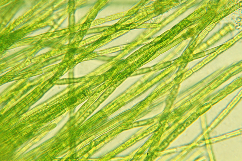 藻类,植物细胞,放大效果,科学探索,显微镜,光显微图,池塘生物,大规模的放大,显微图片,选择对焦