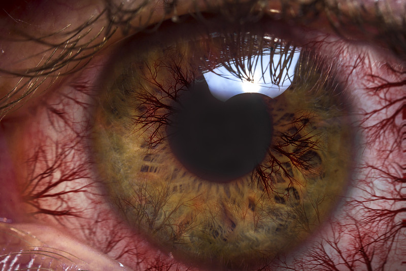 眼球,大特写,红色,身体受伤,青光眼,水平画幅,眼痛,视网膜,结膜炎,特写