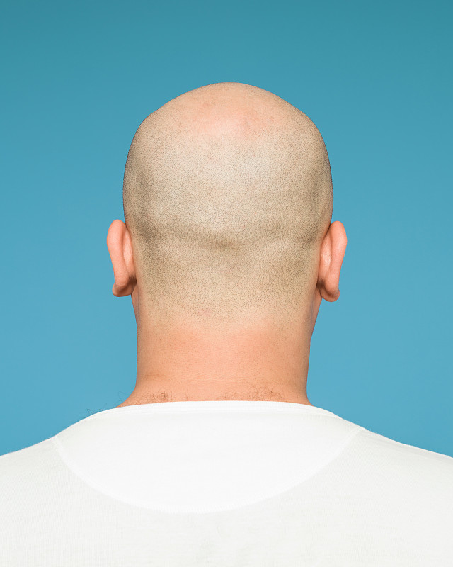 秃头,背面视角,头顶,非全秃,后脑勺,头皮,剃光头,发型,人的耳朵,垂直画幅