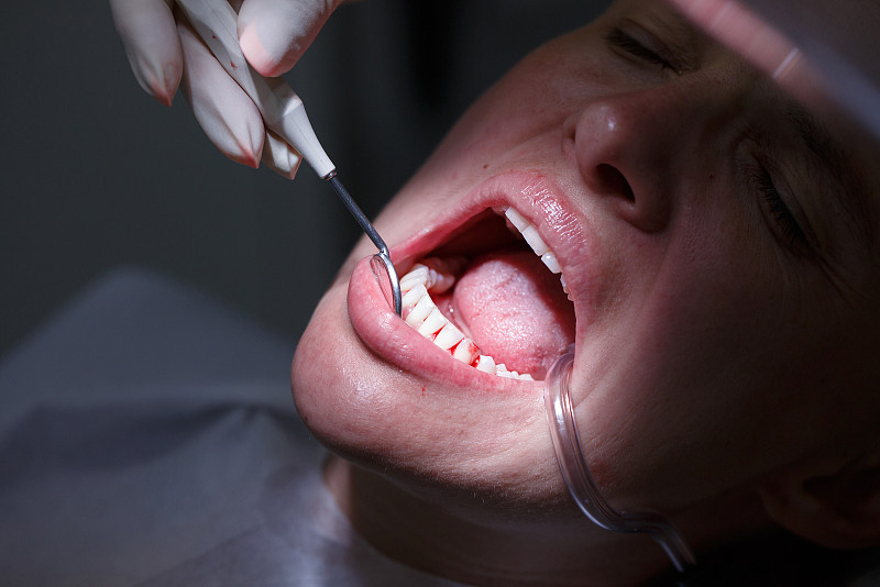 牙医,办公室,女人,牙龈,牙周病,炎症,齿龈炎,牙科设备,人的牙齿,口腔卫生