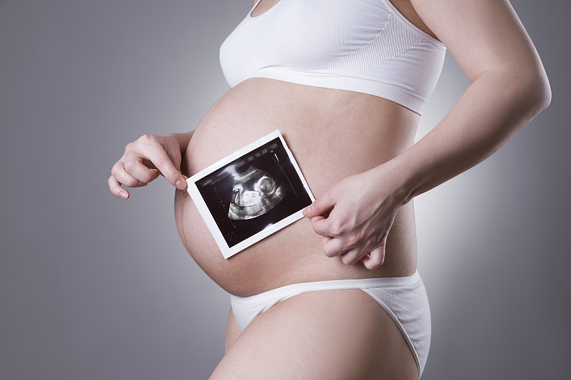 超声波,医学扫描,白色,女人,婴儿,青少年怀孕,胚胎,胎儿,腹腔