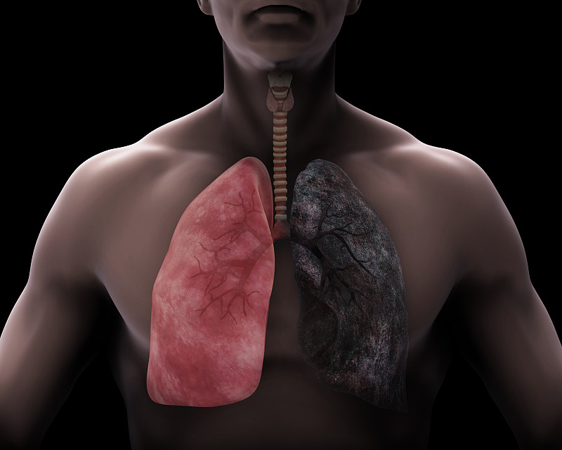 人类肺脏,健康保健,吸烟问题,腺泡,肺气肿,支气管,喉,结核杆菌,气管