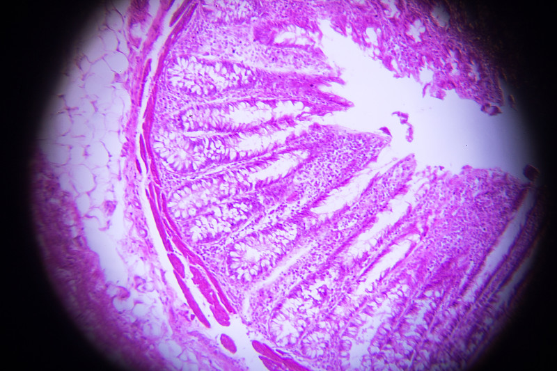 平滑肌,横截面,髓细胞,动脉,基质,细胞核,内皮的,嗜曙红细胞,脊椎,显微图片