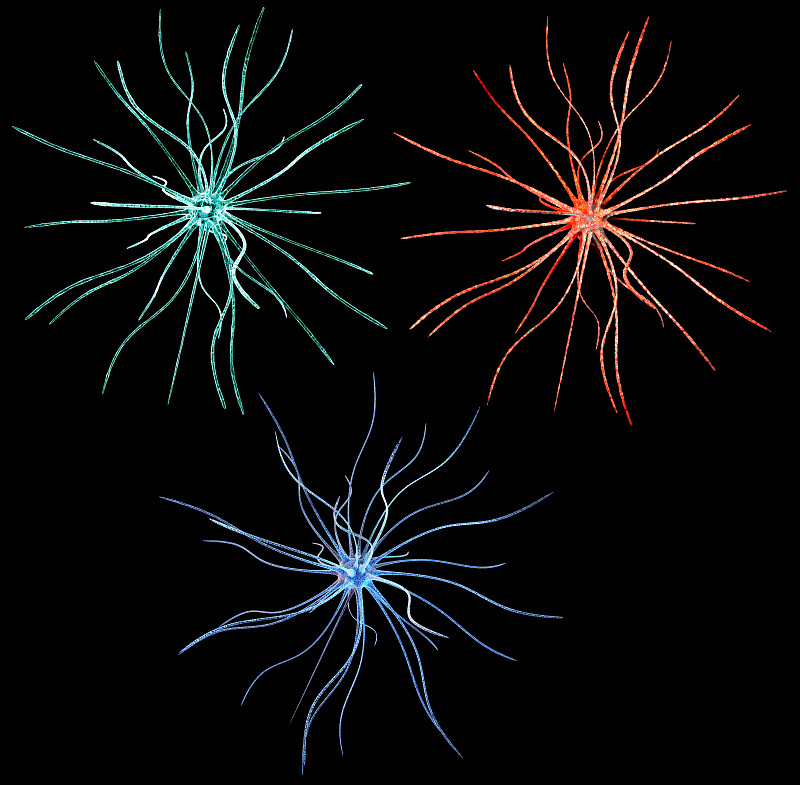 神经元,分离着色,黑色背景,脊髓神经,神经传导,亨丁顿舞蹈症,肾病,神经病,中枢神经系统,硬化症