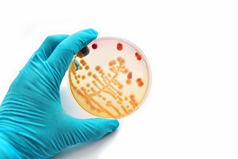 细菌,白喉,马康基氏琼脂,双球菌,绿脓杆菌,血琼脂,克雷白杆菌属,淋球菌,金黄色葡萄球菌,大肠杆菌
