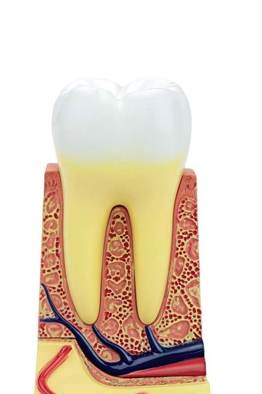 人的牙齿,垂直画幅,洞,变形链球菌,龋齿,牙医,特写,白色,痛苦,人的嘴