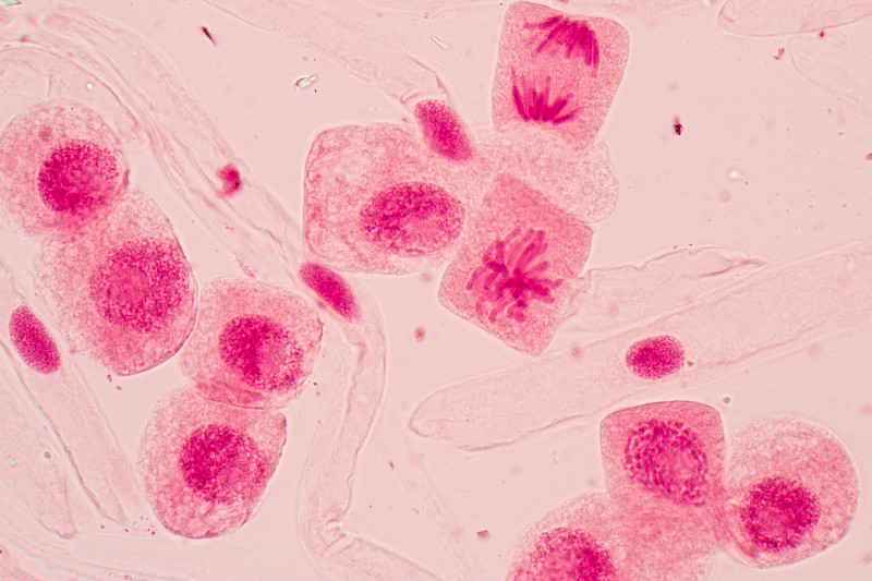 有丝分裂,显微镜,在下面,细胞,洋葱,根尖,后期,末期,纯合子染色体,单倍体