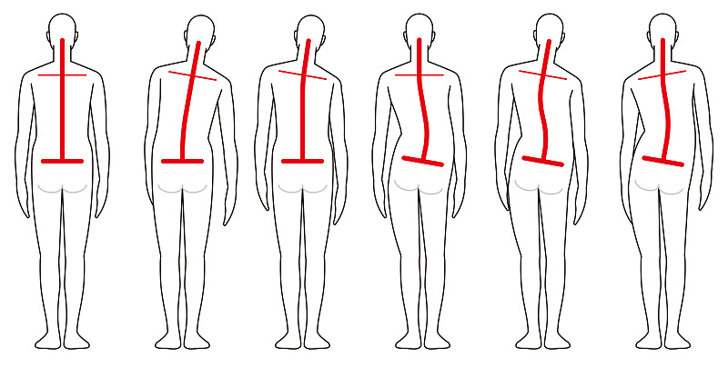 形状,后背,脊骨神经科矫正,水平画幅,绘画插图,脊柱,骨盆,身体活动,姿态,背面视角