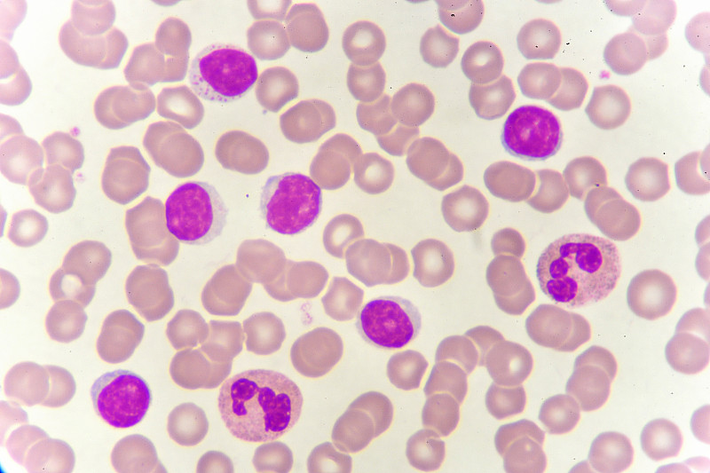 白细胞,嗜碱细胞,海洋性贫血,单核细胞,嗜中性粒细胞,血友病,血小板,嗜曙红细胞,贫血症,红细胞