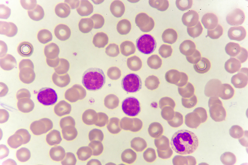 白细胞,嗜碱细胞,海洋性贫血,嗜中性粒细胞,单核细胞,血友病,血小板,嗜曙红细胞,贫血症,红细胞