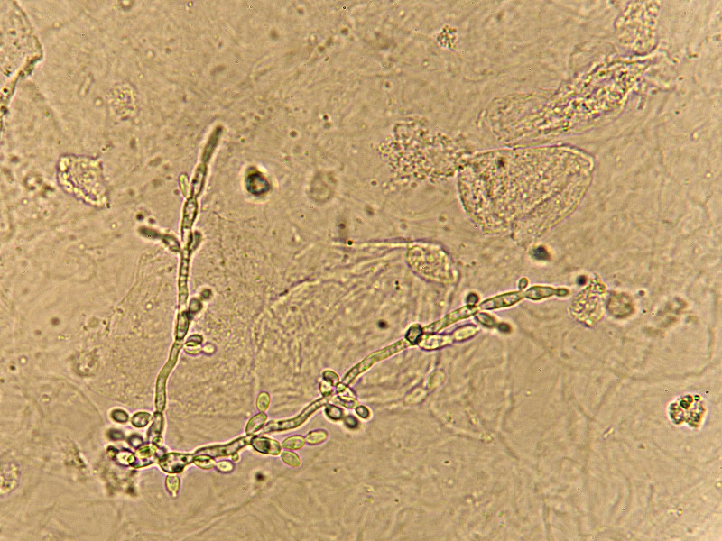 尿液,芽殖酵母,显微镜,水平画幅,酵母,微生物学,沙眼衣原体,科学实验