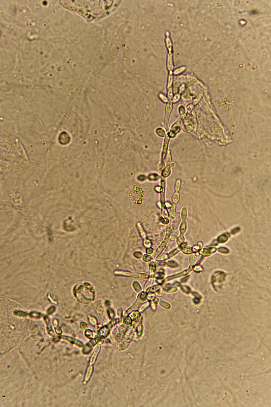 尿液,芽殖酵母,显微镜,垂直画幅,酵母,微生物学,沙眼衣原体,科学实验